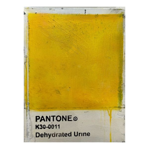 Click Here To Enlarge This Photo Of Dehydrated Urine